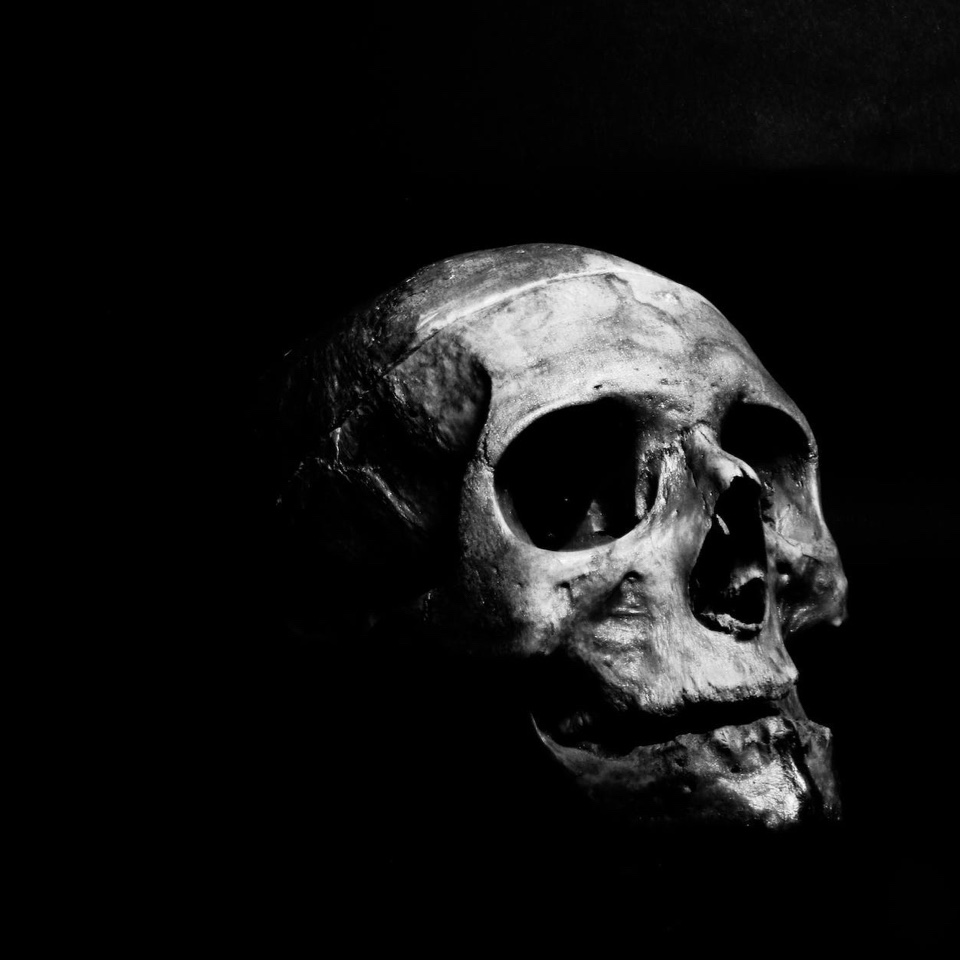 Me & My Bare&nbsp;Bones